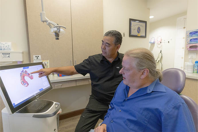 Smile Makeover in San Jose, CA